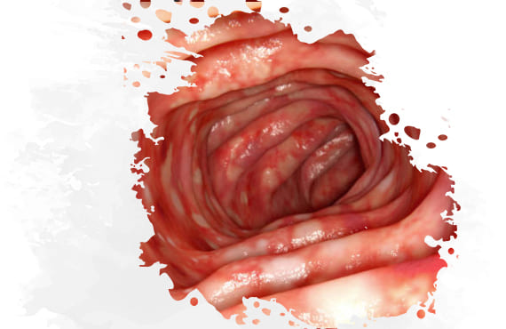 Ventajas de una Endoscopia