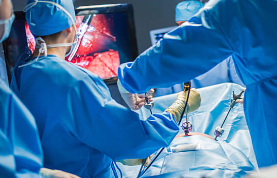 Cirugia general y laparoscopica