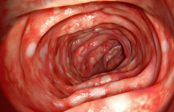 Endoscopia digestiva